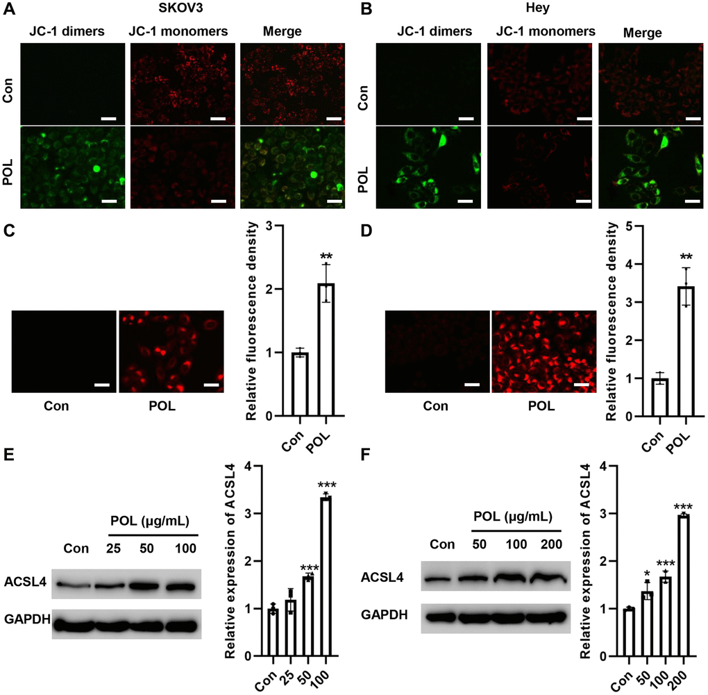 POL increased ACSL4 expression in a concentration gradient-dependent manner. JC-1 analysis showed that POL decreased MMP in SKOV3 (A) and Hey (B) cells (20×). FerroOrange staining showed that POL increased Fe2+ levels in SKOV3 (C) and Hey (D) cells (20×). Western blot assay revealed that POL increased the protein expression level of ACSL4 in SKOV3 (E) and Hey (F) in a concentration gradient-dependent manner. **P ***p 