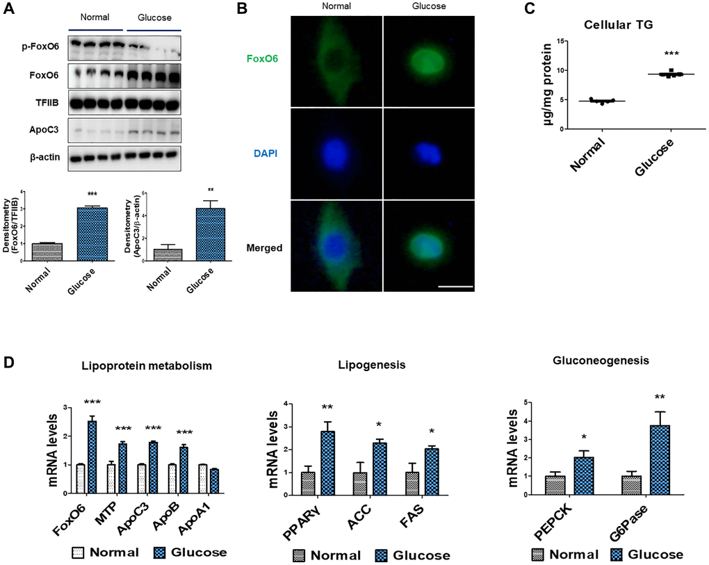 High-glucose induced hyperlipidemia through FoxO6-mediated ApoC3 expression. (A) Western blot was used to detect p-FoxO6, FoxO6 in nuclear extracts, and ApoC3 in cytoplasmic extracts after treatment of AC2F cells with glucose (25 mM) for 6 h. TFIIB was the loading control of the nuclear fractions, whereas β-actin was the loading control of the cytosolic fractions. Results are representative of three independent experiments. Bars in the densitometry data represent the mean ± S.E., and significance was determined using one-factor ANOVA: **p ***p B) Immunohistochemical staining for FoxO6 in cells with high-glucose treatment. Scale bar: 100 μm. (C) Cellular triglyceride contents after glucose treatment (25 mM) for 24 h was measured using a colorimetric assay. Results of one-factor ANOVA: ***p D) Real-time PCR analyses were conducted for measuring the mRNA levels of the lipoprotein metabolism-related genes (MTP, ApoC3, ApoB, and ApoA1), lipogenesis genes (PPARγ, FAS, and ACC) and gluconeogenesis-related genes (PEPCK and G6Pase). Three independent experiments were performed and similar results were obtained. Results of one-factor ANOVA: *p **p ***p 