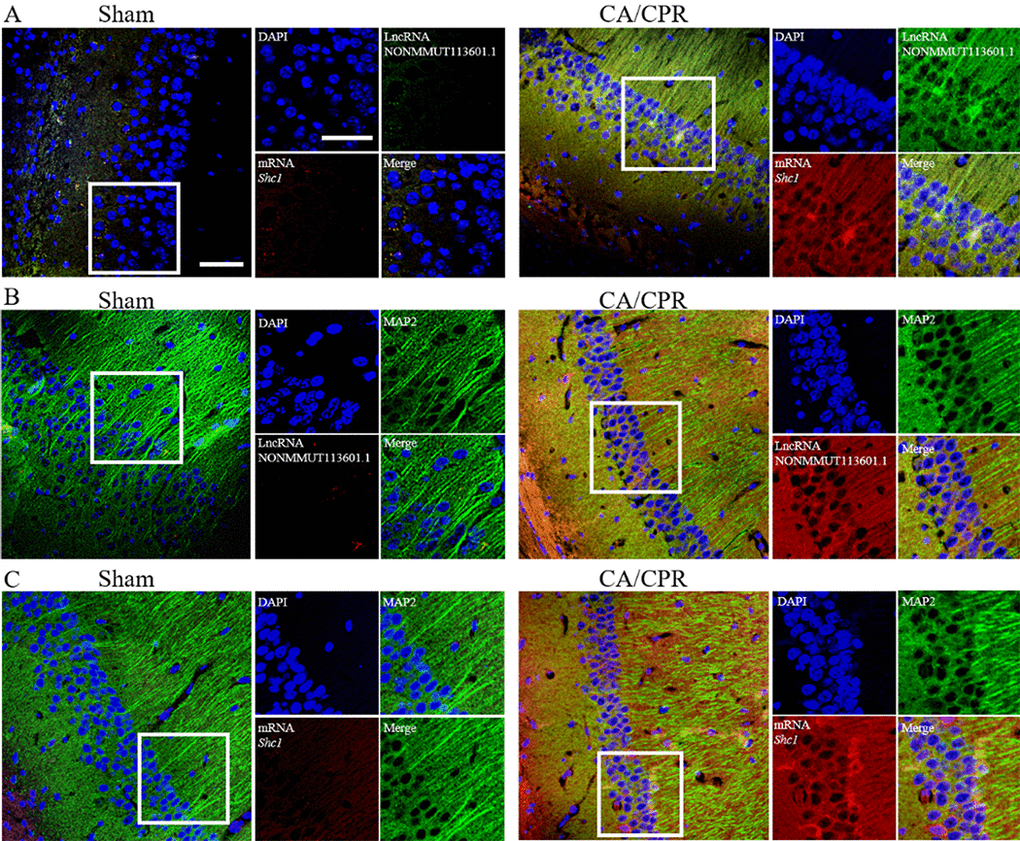 In situ hybridization of lncRNA and mRNA in neuron cells. (A) Biotin-labeled lncRNA and digoxigenin-labeled mRNA probes are shown in green and red, respectively. LncRNA and mRNA are co-expressed in CA1 of the hippocampus. (B, C) The colocation effect of LncRNA (B) or mRNA (C) with MAP-2 labeled neuron cells indicated these correlations mainly happened in neuron cells of the hippocampus. LncRNA and mRNA were labeled by red fluorescent probes, and the neuron cells were marked using anti-MAP2 antibody and Alexa 488 conjugated anti-rabbit IgG. Scale bar: 50 μm.