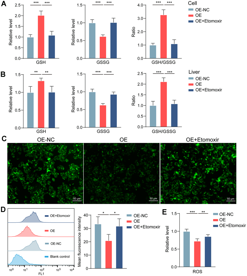 GBA3 maintains mitochondrial homeostasis by reducing ROS. (A, B) Levels of GSH and GSSG were quantified (**, P C) Representative image of ROS detection in cells (Scale bars, 50 μm). (D) ROS was quantified via flow cytometry, P-value was calculated by 2-tailed Student’s t test (*, P E) Hepatic ROS content was quantitatively determined, P-value was calculated by 2-tailed Student’s t test (**, P 