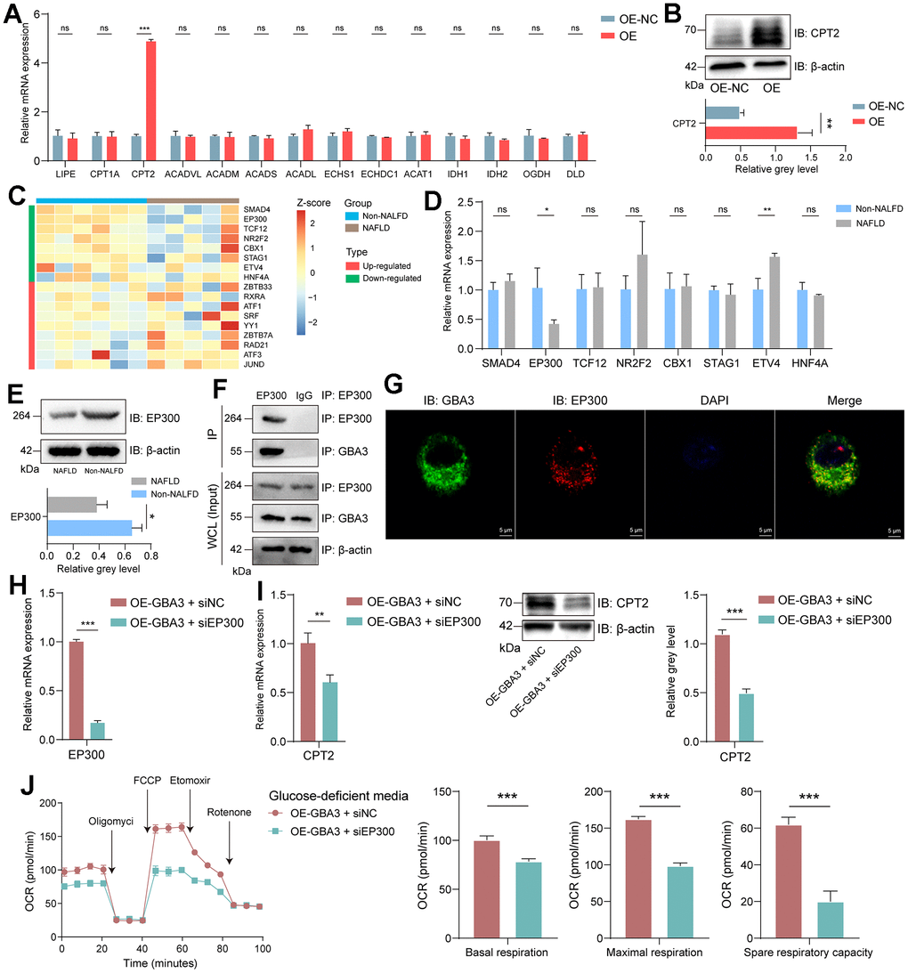 GBA3 interacted with EP300 to promote CPT2 transcription. (A) Relative mRNA expression, P-value was calculated by 2-tailed Student’s t test (***, P B) Immunoblotting detection of CPT2. P-value was calculated by 2-tailed Student’s t test (*, P C) Heat plot showed the normalized expression profile of transcription factors of CPT2 in GSE160016. (D) Relative mRNA expression of 8 transcription factors, P-value was calculated by 2-tailed Student’s t test (*, P E) Immunoblotting detection of EP300. P-value was calculated by 2-tailed Student’s t test (*, P F) Coimmunoprecipitation of GBA3 with endogenous EP300. (G) Representative images of immunofluorescence staining of GBA3 and EP300. Nuclei were counterstained blue with DAPI (Scale bars, 5 μm). (H) Knockdown of EP300 in cells overexpressing GBA3. (I) CPT2 expression was confirmed through PCR and Western blot. P-value was calculated by 2-tailed Student’s t test (***, P J) Respiratory rates expressed as oxygen consumption rate (OCR) were measured using Seahorse metabolic analyzer. P-value was calculated by 2-tailed Student’s t test (***, P 