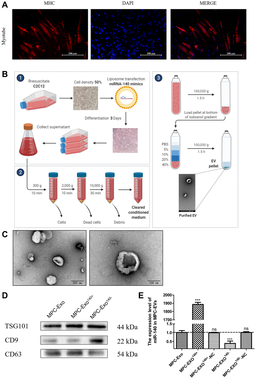 Production and identification engineered exosomes containing miR-140-5p mimics or inhibitors. Preparation and identification of MPC-EVs. (A) illustrates the formation of myotubes post differentiation of C2C12 cells, shown via IF with red representing the heavy chain myosin (MYH) and blue for DAPI-stained nuclei (Scale bar in 200 μm). (B) depicts the preparation process of MPC-EVs. (C) presents the TEM results, showing the characteristic cup-shaped or semispherical morphology of the myogenic extracellular vesicles, in agreement with the expected bilayer membrane ultrastructure of extracellular vesicles. (D) shows WB results indicating positive reactions for the marker proteins TSG101, CD9, and CD63 in all types of MPC-EVs. (E) illustrates RT-PCR results (fold change), showing the miR-140-5p levels in MPC-Exo140+ and MPC-Exo140−, which are 1800 times and 1/3 of normal extracellular vesicles, respectively. MPC-Exo140+-NC and MPC-Exo140−-NC showed no difference from normal extracellular vesicles. Different letters between bars mean P ≤ 0.05 analyses followed by non-paired Student’s t-test. nsp > 0.05, *p **p ***p 