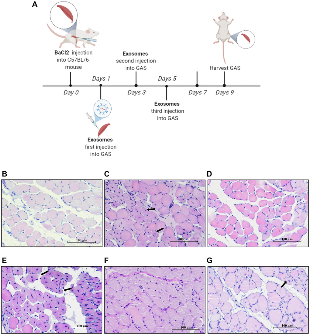 MPC-EXO and MPC-Exo140− advanced the repair of gastrocnemius muscle after acute injury. Eight-week-old male wildtype C57BL/6 mice were treated with MPC-Exo, MPC-Exo140+ and MPC-Exo140− 3 times after acute injury. (A) presents a schematic diagram of muscle injury modeling treated with MPC-EVs. (B–G) depict the HE staining results after three treatment sessions, with arrows pointing to central nuclei. The control group (B) shows closely arranged muscle cells with nuclei at the cell periphery. The injury group (C) presents newly formed muscle cells with centrally located nuclei and a few inflammatory cells between cells. In the MPC-Exo intervention group (D), the nuclei of newly formed muscle cells migrated toward the cell membrane. The MPC-Exo140+ intervention group (E) shows numerous centrally located nuclei in newly formed muscle cells and a loose extracellular matrix structure. In the MPC-Exo140− intervention group (F), the muscle cells were closely arranged, and the nuclei of newly formed muscle cells moved to the cell periphery. The AAV-KO-140 injury group (G) shows newly formed muscle cells with nuclei relocated to the cell periphery, but the fusion process between cells and newly formed multinucleated myotubes is inhibited, resulting in a significant increase in the number of nuclei (Scale bar in 100 μm).