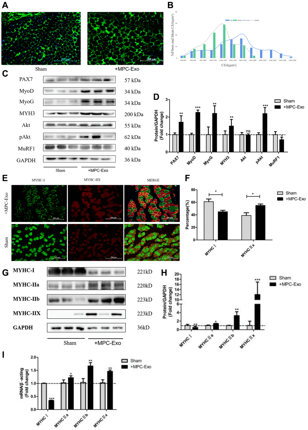 MPC-Exo promote muscle development by activating satellite cells and fiber type transformation. Eight-week-old male wildtype C57BL/6 mice were treated with MPC-Exo 3 times. (A) uses laminin immunofluorescence staining to mark the changes in the cross-sectional area of the gastrocnemius muscle after injection (Scale bar in 200 μm). (B) presents a statistical analysis of its fiber area frequency distribution. (C, D) show WB results, revealing increased expression of muscle regeneration-related proteins and muscle protein synthesis metabolic proteins, as well as decreased expression of muscle protein breakdown metabolic proteins after three injections. (E) and (F) show IF results, indicating a decrease in MyHC I (green fluorescence) and an increase in MyHC IIx (red fluorescence) after injection (Scale bar in 100 μm). (G–I) show WB and RT-PCR results, indicating a transition of muscle fiber type from slow-twitch to fast-twitch. Different letters between bars mean P ≤ 0.05 analyses followed by non-paired Student’s t-test. nsp > 0.05, *p **p ***p 