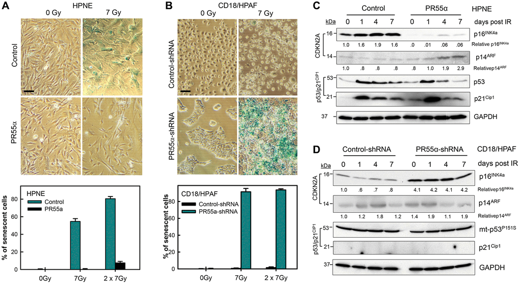 PR55α inhibits IR-induced cellular senescence. (A) Ectopic PR55α overexpression prevents senescence induction by IR in normal HPNE cells. HPNE/PR55α and HPNE/control cells were incubated in the presence of 1 μg/ml Dox for 2 days (to induce ectopic PR55α in the HPNE/PR55α cells) and then exposed to 7 Gy IR or left unirradiated as control (0 Gy). When the second radiation dose was applied, the interval was 24 hours between the two doses. Seven days post-IR, cells were assessed for SA-β-gal activity and photographed. Scale bar = 1 μm. The bar graph expresses the percent of senescent cells in the indicated samples and represents the mean ± S.D. of two separate experiments with each done in duplicate samples. (B) PR55α-knockdown sensitizes CD18/HPAF pancreatic cancer cells to senescence induction by IR. CD18/HPAF cells expressing Dox-inducible PR55α-shRNA or Control-shRNA were cultivated in the presence of 2 μg/ml Dox for 5 days, to allow time to silence PR55α expression, and then exposed to 7 Gy IR, or left unirradiated as a control (0 Gy). After 7 days, the cells were assessed for SA-β-gal activity and photographed. Scale bar = 1 μm. The graphs express the percent of senescent cells in the indicated samples and represent the mean ± S.D. of two separate experiments with each one in duplicate samples. (C, D) Normal HPNE and CD18/HPAF pancreatic cancer cells, with/without PR55α manipulation, were exposed to 7 Gy IR, or left unirradiated as a control (0 day). When the second radiation dose was applied, the interval was 24 hours between the two doses. The irradiated cells were incubated for the times indicated and analyzed by immunoblotting for the differences in levels of p16, p14, p53, and p21. GAPDH was used as an internal control.