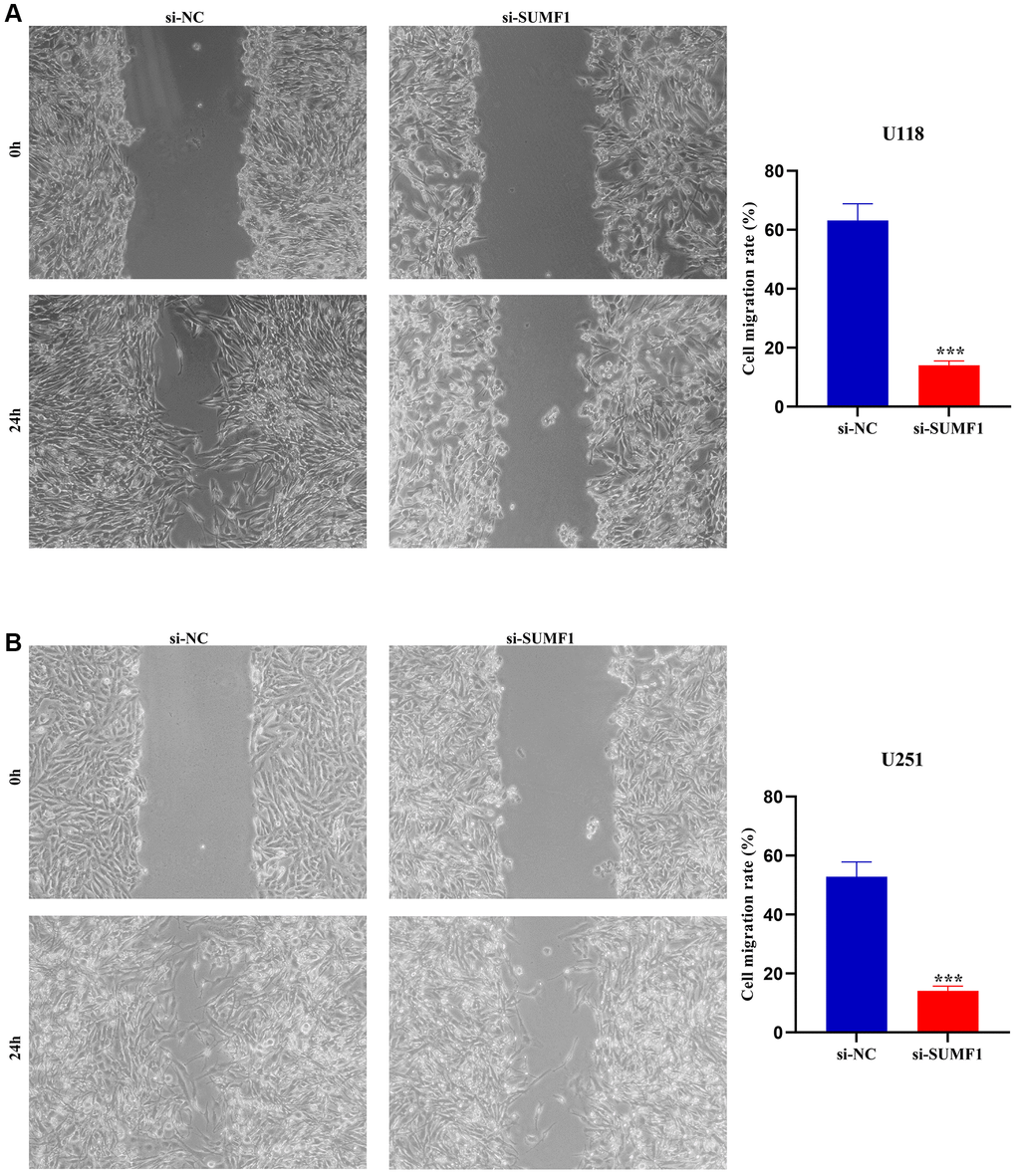 Wound healing shows that inhibiting the expression of SUMF1 deters the migration of glioma cells. (A) U118 cells; (B) U251 cells.