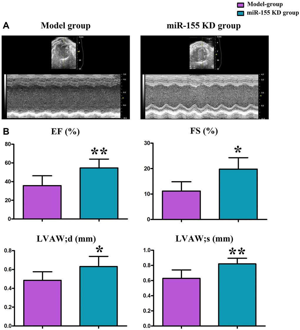 Changes in left ventricular morphology and function as shown by cardiac ultrasound. (A) Cardiac ultrasound. (B) Changes in EF (%), FS (%), LVAWd (mm), and LVAW; (mm).