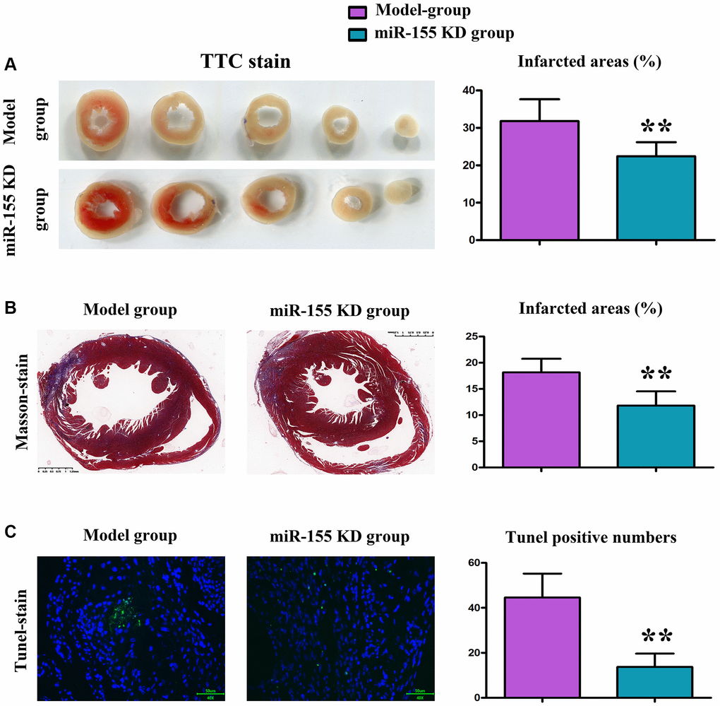 Changes in myocardial infarction (MI) in mice. (A) TTC staining of myocardial tissue and MI area. (B) Masson staining of myocardial tissue and MI area. (C) Results of TUNEL staining and number of positive apoptotic cells.