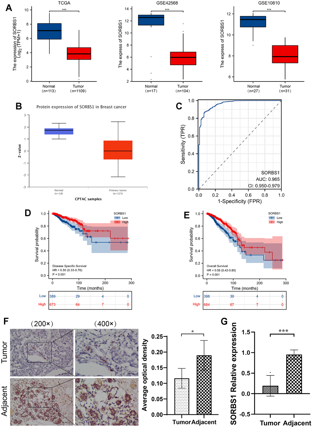 Relative expression of SORBS1 in breast cancer based on raw letter analysis. (A) The expression of SORBS1 mRNA in breast cancer and non-matched normal tissues based on the TCGA database, and the expression of SORBS1 mRNA in breast cancer tissues and adjacent tissues based on the GEO database. (B) The protein expression level of SORBS1 is based on CPTAC. (C) ROC curves of breast cancer and normal breast tissue classified in TCGA database. (D, E) Prognostic values of SORBS1 expression in patients with breast cancer evaluated by the Kaplan-Meier method. Overall survival and disease-specific survival (B) for breast cancer patients with high versus low SORBS1. (F) Representative images of SORBS1 protein expression in BRCA tissues and adjacent normal tissues. Original magnifications 200× and 400×. (G) Quantitative real-time PCR analysis of BRCA tissues and adjacent normal tissues. (***P