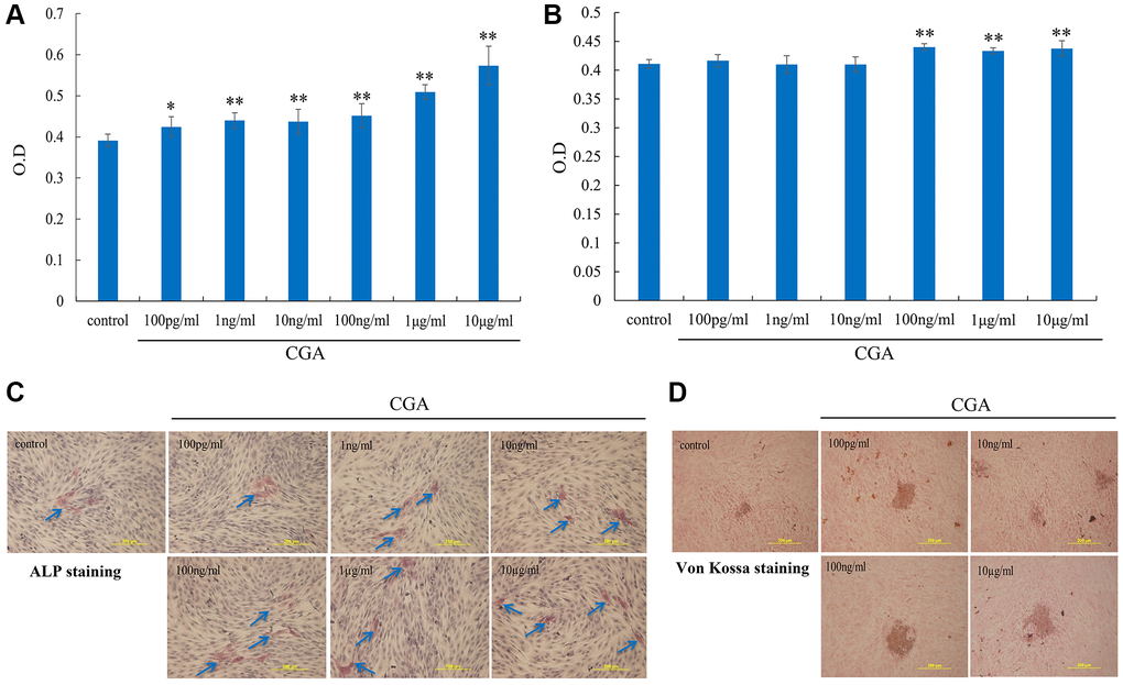 Chlorogenic acid increases proliferation and differentiation in osteoblasts. (A) MG-63 cells were treated indicated concentration of chlorogenic acid for 2 days, the cell viability was examined by MTT assay. (B) MG-63 cells were treated indicated concentration of chlorogenic acid for 2 days, the ALP activity was examined by ALP activity kit. MG-63 cells were incubated with osteoblast differentiation medium (vitamin C (50 μg/mL) and β-glycerophosphate (10 mM)) and chlorogenic acid for 3 and 21 days, the bone mineralization was examined by ALP (C) and von Kossa (D) staining. *p 