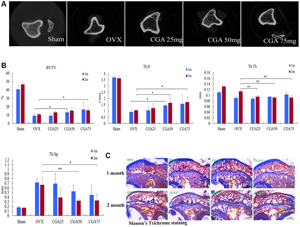 Chlorogenic acid prevents OVX-induced bone loss. (A) Photomicrographs showing axial views of micro-CT images. (B) Graphic illustrations of bone volume fraction (BV/TV), trabecular number (Tb. N.), trabecular thickness (Tb. Th.) and trabecular separation (Tb. Sp.) in the indicated groups. (C) Histological sections from tibia stained with Masson’s. *p 