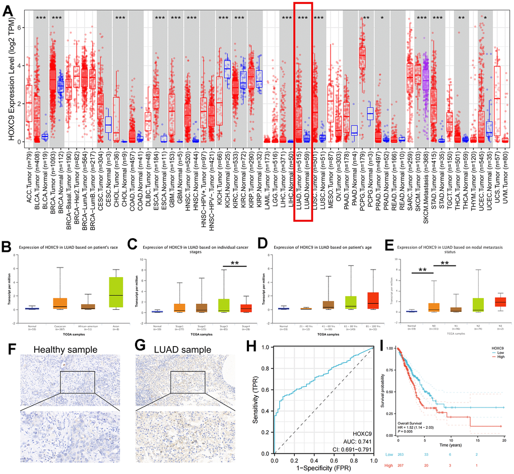 Analyses of HOXC9 expression and the diagnostic and prognostic value in LUAD. (A) The expression distribution of HOXC9 in tumor tissues and normal tissues with TIMER2, respectively; (B–E) The correlation between HOXC9 expression and clinical variables of LUAD; (F) The HOXC9 protein level in adjacent healthy tissue; (G) and in the tumor tissue; (H) The diagnostic value of HOXC9 in LUAD; (I) The OS analysis of HOXC9 in LUAD patients. (*, P