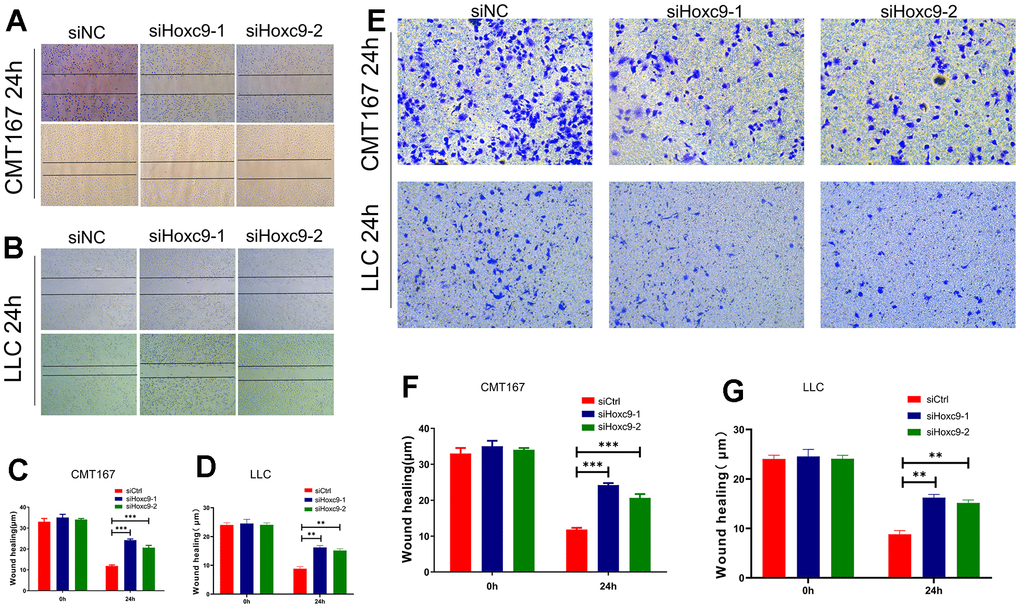 Hoxc9 knockdown inhibited the migration and invasion of tumor cells. (A) Remaining length of wound of CMT167 under knockdown of Hoxc9 was significantly longer compared to control (200 μm). (B) Remaining length of wound of LLC under knockdown of Hoxc9 was significantly longer compared to control (200 μm). (C, D) The statistical analysis of above assays. (E–G) Count of migrated CMT167 and LCC cells was significantly decreased after knockdown of Hoxc9. (*P