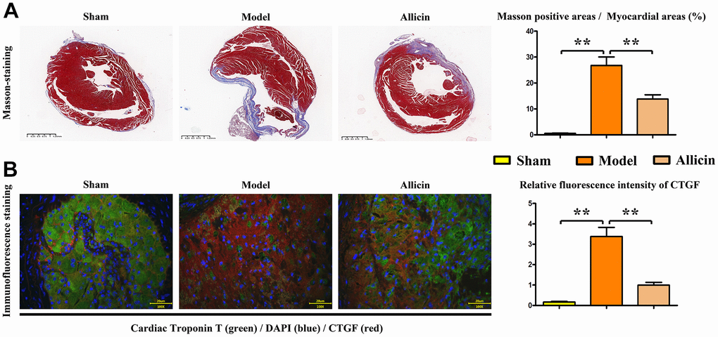 Quantification of myocardial fibers and immunofluorescence staining of CTGF in Masson's-stained mice. (A) Masson's staining of mouse hearts and the corresponding data. (B) Dual immunofluorescence staining of myocardial troponin T (T) and CTGF, and statistical analysis of CTGF intensity to evaluate the severity of cardiac fibrosis. One-way analysis, **p 