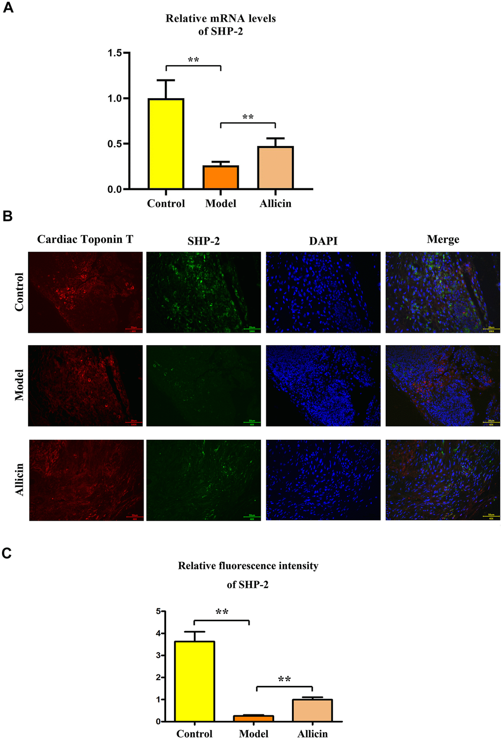 Detection of SHP2 expression using RT-PCR and immunofluorescence. (A) RT-PCR analysis of SHP2 mRNA expression, with corresponding statistical data. One-way analysis, **p B) Immunofluorescence staining for SHP2 expression and statistical analysis. One-way analysis, **p C) SHP2 fluorescence intensity statistical analysis. One-way analysis, **p 