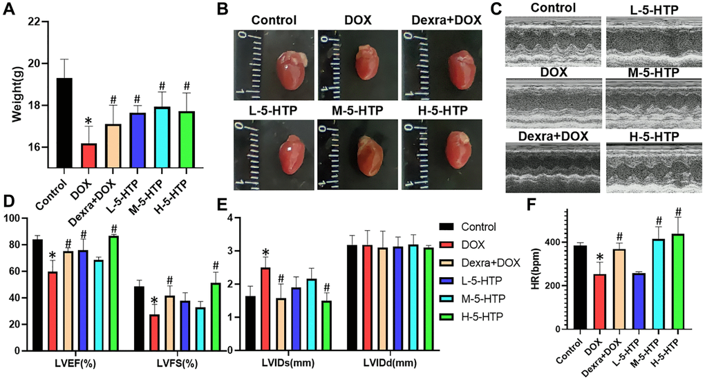 5-HTP ameliorates DOX-induced cardiac dysfunction of myocardial tissue in mice. (A) Bodyweight of mice on the last day of the experiment; (B) Morphology of the mice heart; (C) Representative echocardiographic images; (D) Left ventricular ejection fraction (LVEF) and left ventricular fractional shortening (LVFS); (E) Left ventricular internal diastolic end-systolic (LVIDs) and left ventricular internal diastolic end-diastolic (LVIDd); (F) Heart rate (HR); *P #P 