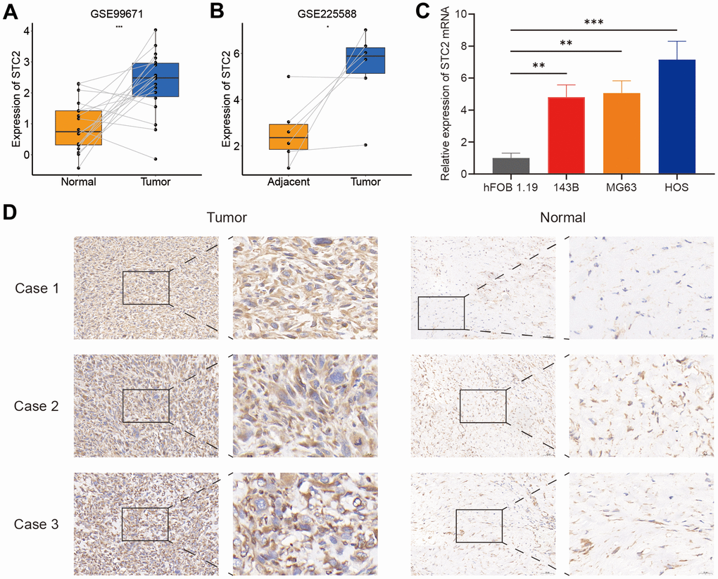 The expression levels of STC2. (A, B) The STC2 expression level in osteosarcoma and non-tumoral paired samples, based on the GSE99671 and GSE225588 cohort. (C) The qRT-PCR result of STC2 in hFOB 1.19, 143B, MG63, HOS cell lines. (D) The expressions of STC2 in tumor and adjacent normal tissues. *P