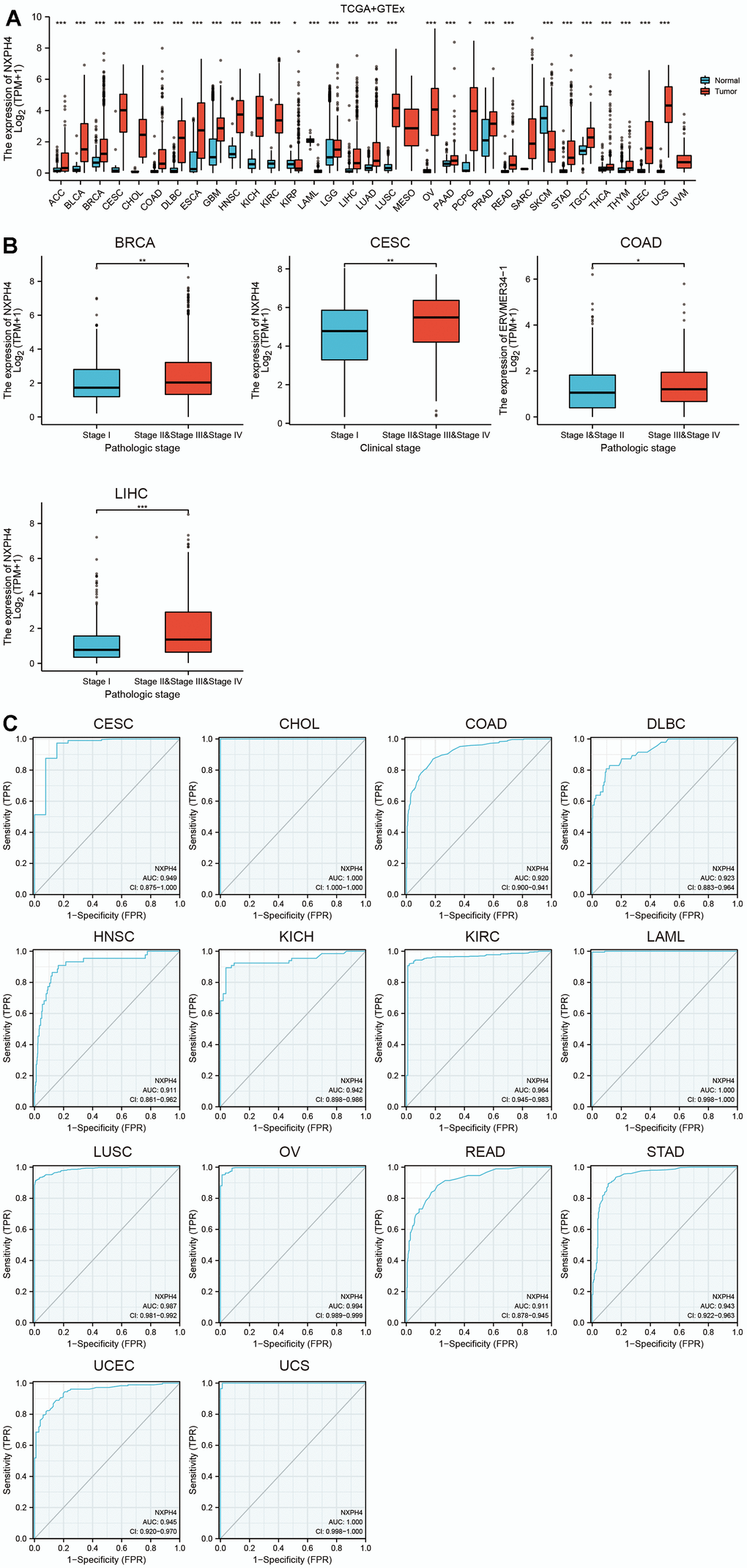 Abnormal expression and diagnostic ability of NXPH4 in pan-cancer. (A) Differential expression of NXPH4 between pan-cancer and corresponding normal tissues in TCGA combined GTEx database. (B) Differential expression of NXPH4 in early and late cancer tissues of BRCA, CESC, COAD, and LIHC. (C) Diagnostic ROC curve of NXPH4 in pan-cancer.