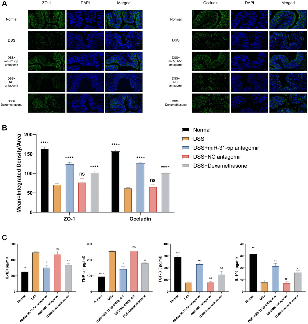 mir-31-5p antagomir restored intestinal mucosal tight junction protein and reduced colonic inflammation in DSS-induced colitis mice. (A) Immunofluorescence staining of ZO-1 and occludin in colon tissue (x200 magnification). (B) Quantitative fluorescence analysis of ZO-1 and occludin (ordinate represented the average fluorescence intensity analyzed by ImageJ software). (C) ELISA analysis of the expression of IL-1β, TNF-α, TGF-β and IL-10 in colon. Each bar represents mean ± SD, n ≥ 3 from each group. ns represented P > 0.05, *P **P ***P ****P 