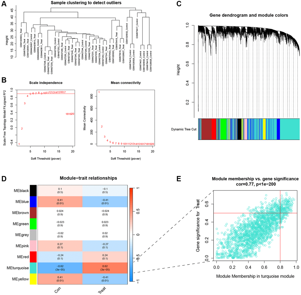 Identification of key genes for IVDD. (A) Cluster dendrogram of 39 IVD. (B) The scale independent value exceeded 0.9 with a low average connectivity when the soft threshold power was 5. (C) Cluster dendrogram of disease genes to identify clinically meaningful modules associated with IVDD development. (D) Heatmap of the correlation between gene modules and clinical traits of IVDD. (E) The scatterplot of Gene Significance vs. Module Membership in the turquoise modules.