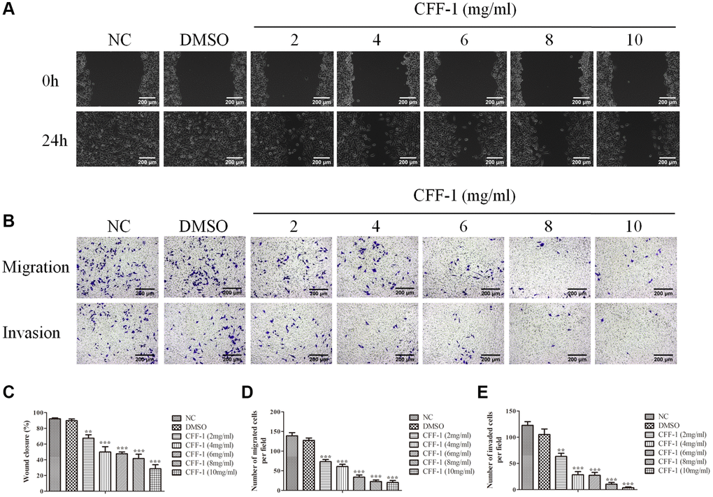 CFF-1 inhibited PCa cells migration and invasion. (A) Wound healing abilities of PC-3 cells in the presence of NC, DMSO and varying concentrations of CFF-1, with images captured at 0 and 24 hours post-wounding. (B) Representative images showing transwell migration and invasion assay of PC-3 cells treated with NC, DMSO and varying concentrations of CFF-1. (C) Quantitative analysis of the wound healing assay with different treatment conditions. (D) Quantitative analysis of the transwell migration assay. (E) Quantitative analysis of the transwell invasion assay. **p ***p 