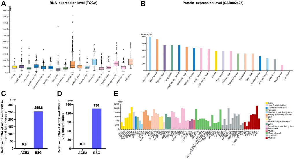 Expression of BSG in tumor tissues and cancer cells. (A) mRNA expression levels of BSG (TCGA) across multiple cancer types. (B) Protein expression levels of BSG (CAB002427) across multiple cancer types. (C) Relative mRNA expression levels of ACE2 and BSG in normal lung tissues. (D) Relative mRNA expression levels of ACE2 and BSG in lung cancer tissues. (E) mRNA expression levels of BSG in the multiple cancer and normal cells. The cancer types were color-coded according to which type of normal organ the cancer originates from. The cell lines were classified into 16 color-coded groups according to their organ to which it is from. Abbreviations: TPM: transcripts per million; FPKM, number of fragments per kilobase of exon per million reads.