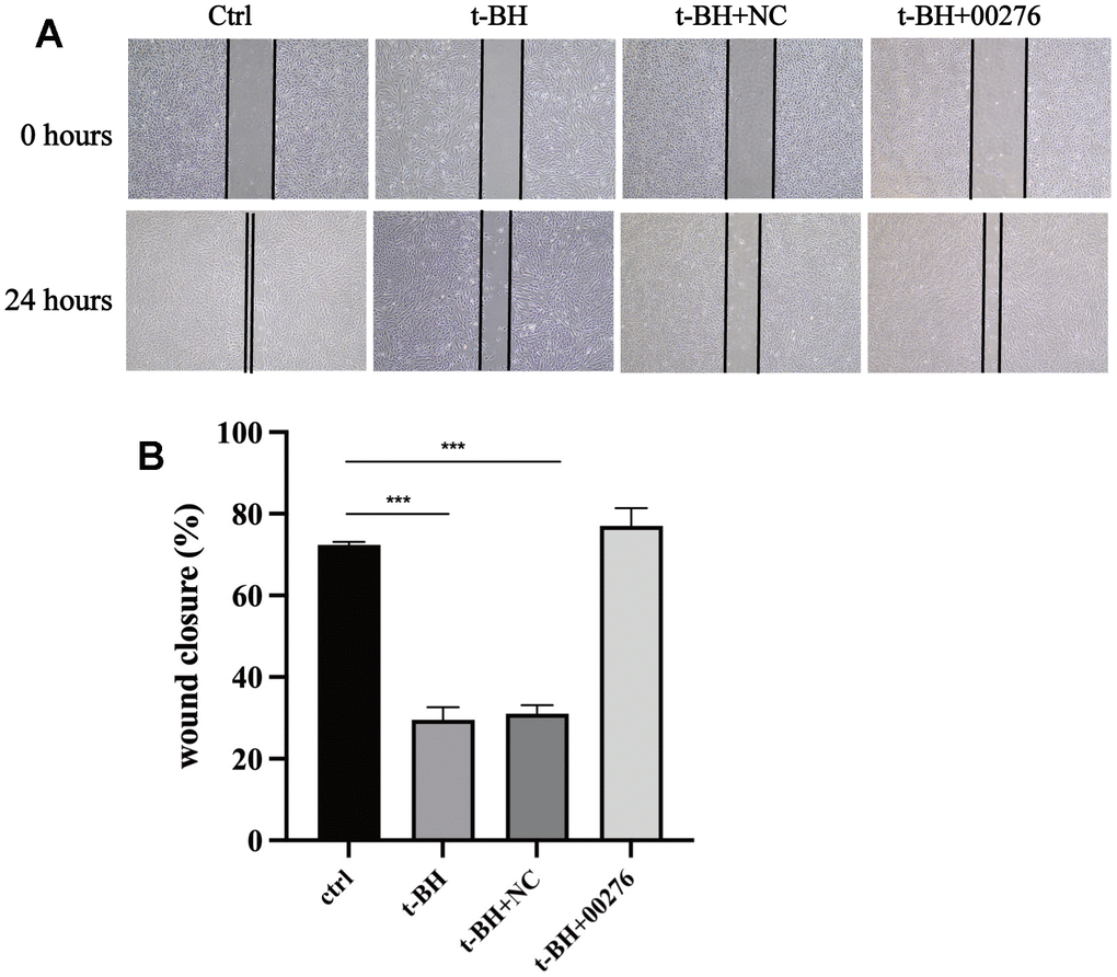 Cells wound healing analysis. (A) The wound area was marked with two black lines. The wound healing ability of APRE-19 cells after t-BH treatment was attenuated compared with the blank group. (B) Wound healing ability of the cells was significantly improved after LINC00276 overexpression. *** means P