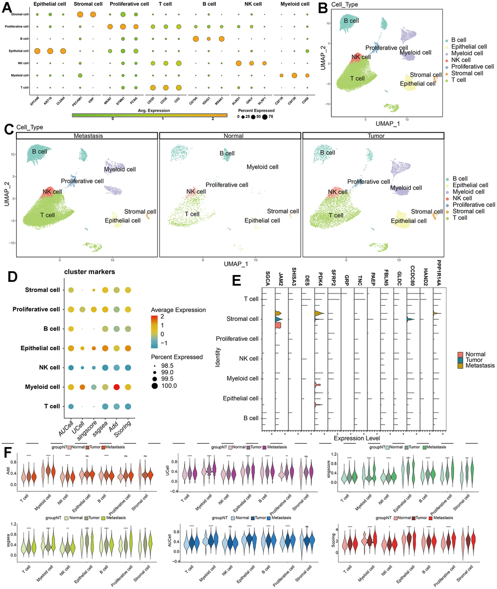 Single-cell annotation and parthanatos scores prediction. (A) Expression of specific marker genes in 7 cell types. (B, C) Dimension reduction and annotation of cell clusters based on UMAP algorithm. (D) 5 algorithms scored the gene sets of seven cell clusters. (E) Comparison of the expression difference of 14 model genes in 7 cell types of normal tissue, tumor tissue and metastatic tissue. (F) Comparison of gene set scores of 7 cell clusters among normal tissue, tumor tissue and metastatic tissue.