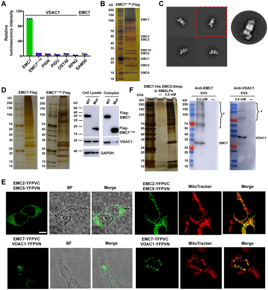 In vivo association between EMC and VDAC1. (A) ER membrane proteins PIGK, PIGU, OST48 and RPN2 were tagged on their cytoplasmic side. Mitochondrial outer membrane protein SAM50 was tagged at its C-terminus. Luminescence intensities were measured to quantify the strength of the protein-protein interactions, and the intensity of VDAC1 with EMC7 was set as 100 for each experiment. The result represents mean ± s.e.m from n = 3 independent experiments. (B) A silver staining image of the SDS-PAGE gel for the human EMC complex purified from Expi293 cells that lack endogenous EMC7 but express C-terminal Flag-tag EMC71–156 ectopically. (C) Representative reference-free 2D negative staining-EM average of the purified mutant EMC. (D) The truncation mutant EMC71–156 attenuates the formation of EMC-VDAC1 complex. Left: Silver-stained SDS-PAGE of the purified EMC complex. Right: Western blot analysis of the purified EMC complex and whole cell lysate using antibodies as indicated. (E) BiFC assay examining the location of the EMC-VDAC1 complex. Proteins are fused either to the N-terminal fragment (-YFPVN) or to the C-terminal fragment (-YFPVC) of YFP. Mitochondria were stained by MitoTracker probes. BF: Bright field. Scale bar: 5 μm. (F) Purification of the EMC complex in the native lipid environment. Left: Silver-stained SDS-PAGE of the purified EMC complex in SMALPs with or without EGS crosslinker. Right: Western blot analysis of the purified EMC complex using antibodies as indicated. * indicates the cross-linked form of the target proteins.