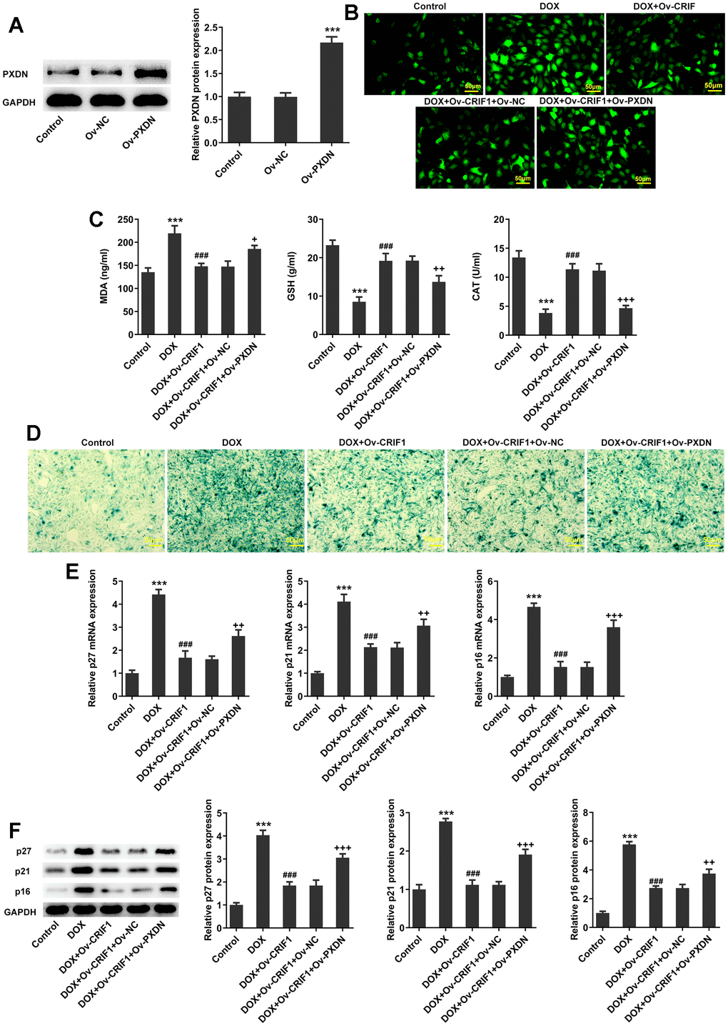 CRIF1 overexpression alleviated oxidative stress and cell senescence by inhibiting PXDN in DOX-induced AC16 cells. (A) AC16 cells were transfected with Ov-NC or Ov-PXDN, and the overexpression efficacy of PXDN was detected by western blot. ***PB) DCFH-DA staining was used to detect ROS levels. (C) The expression levels of MDA, GSH and CAT in cells were detected by biochemical kits. (D) SA-β-gal staining was used to observe the level of cell senescence. (E, F) RT-qPCR and western blot detected the expression of p27, p21, and p16. ***P