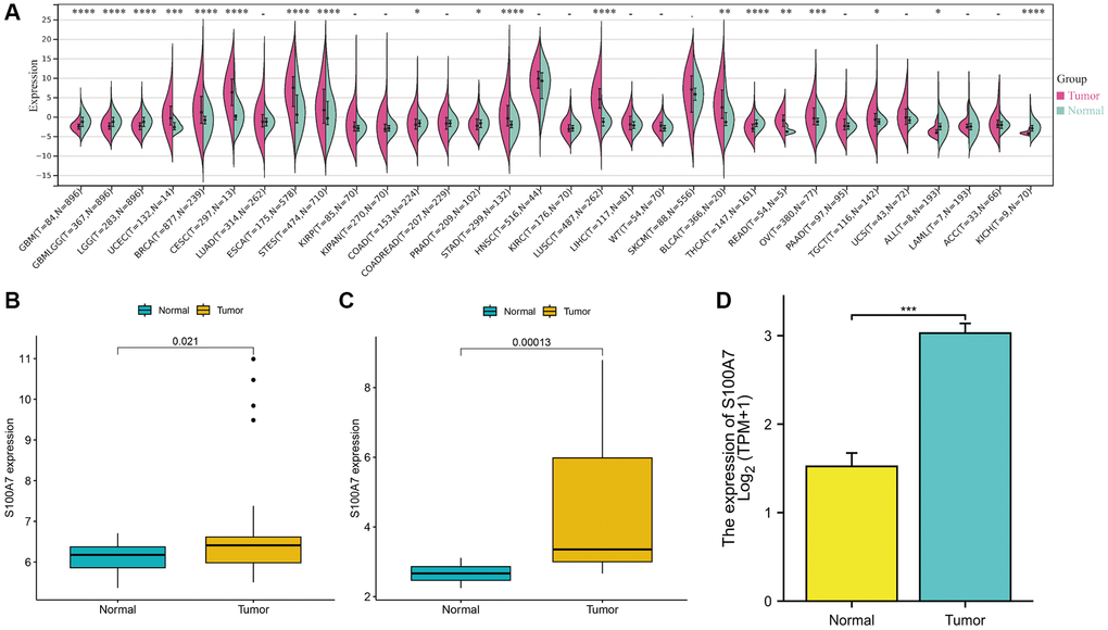 The pan-cancer expression of S100A7. (A) S100A7 expression from TCGA + GTEx microarray data. (B) S100A7 expression from GSE15852 data. (C) S100A7 expression in breast cancer and normal breast tissues from GSE10797 data. (D) S100A7 expression in breast cancer and normal breast tissues from TCGA-BRCA data. Abbreviations: TCGA: The Cancer Genome Atlas; GTEx: Genotype-Tissue Expression.