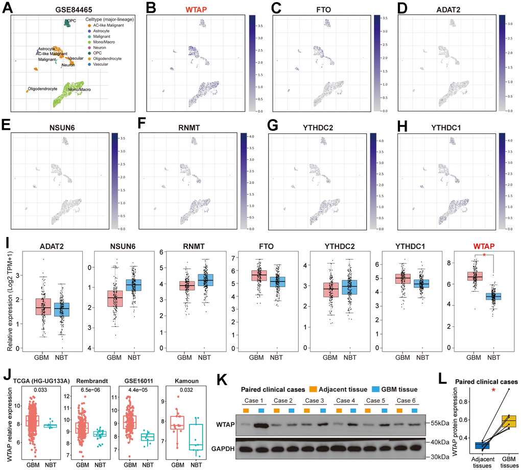 Further screening of RNA modification genes. (A) The scatterplot presented the eight kinds of cells with different colors in the TME of GBM based on the GSE84465 dataset. (B) The scatterplot presented the expression of WTAP in different types of cells. (C–H) The scatterplot presented the expression of FTO, ADAT2, NSUN6, RNMT, YTHDC2, and YTHDC1 in different types of cells. (I) Differential expression analysis of seven RNA modification genes between GBM tissues and NBTs. (J) The differential expression analysis of WTAP between GBM tissues and NBTs was performed in four independent GBM cohorts. (K) Western blot detection of the WTAP protein expression levels in paired GBM tissues and adjacent nontumor tissues. (L) Compared with adjacent nontumor tissues, WTAP protein expression was up-regulated in GBM tissues. *P 