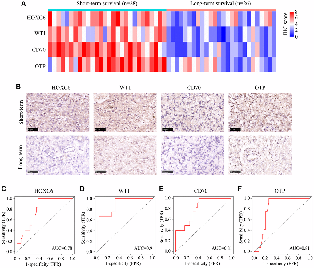 Expression of HOXC6, WT1, CD70, and OTP in 54 glioma cases with TERTp mutations. TERTp-mutant glioma samples from 54 glioma patients admitted to our hospital were divided into long- and short-term survival groups based on a survival cut-off of 15 months. (A) IHC scores for HOXC6, WT1, CD70, and OTP expression in glioma samples from patients in the long- and short-term survival groups. (B) Representative IHC images showing the expression of HOXC6, WT1, CD70, and OTP in glioma samples from patients in the long- and short-term survival groups. (C–F) Diagnostic value of HOXC6, WT1, CD70, and OTP for distinguishing long- and short-term survivors among glioma patients with TERTp mutations.