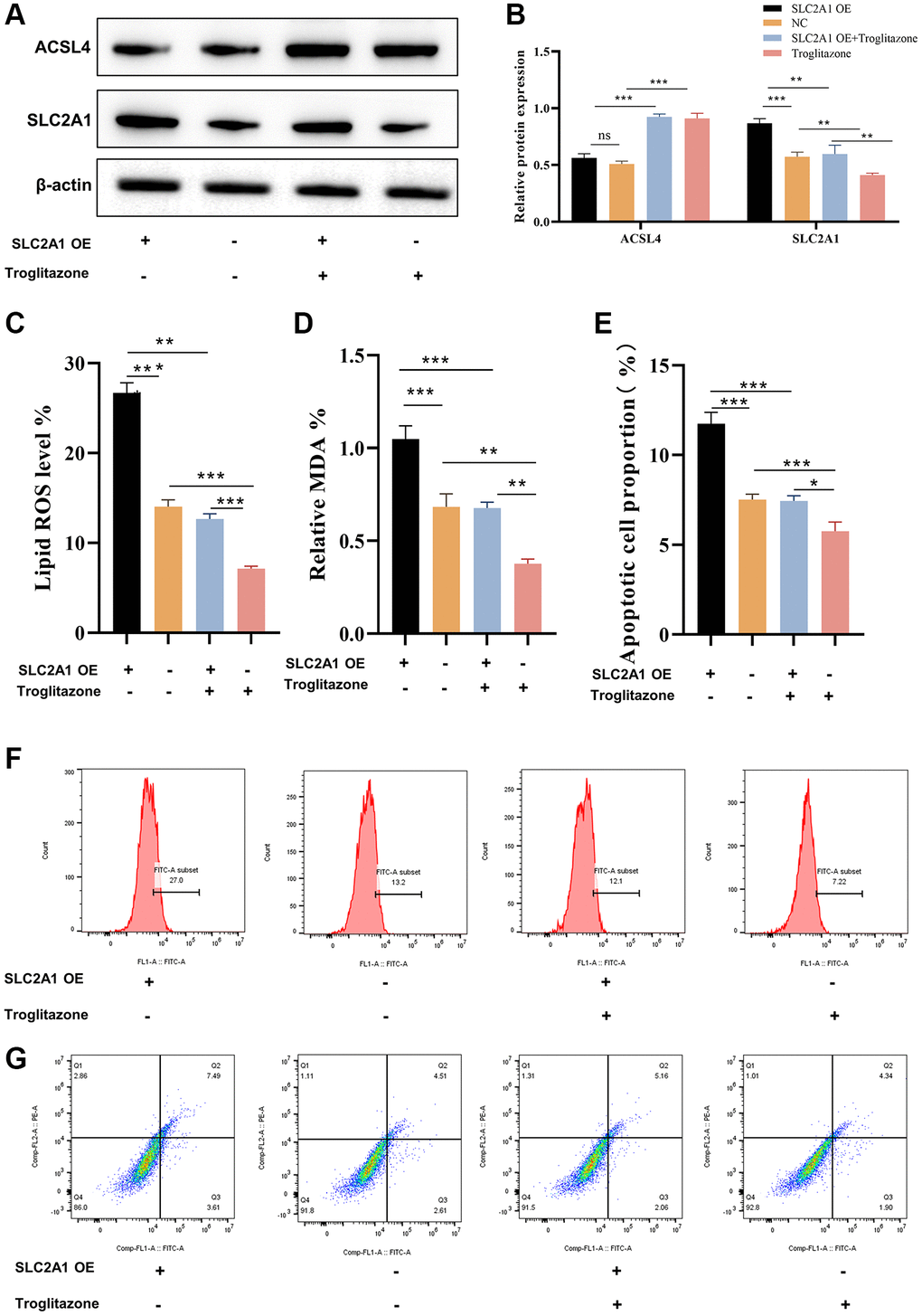 SLC2A1 promotes HK-2 cell apoptosis and ferroptosis via ACSL4. (A, B) The protein level of ACSL4 and SLC2A1 in HR induced AKI mode when overexpressed SLC2A1, overexpressed SLC2A1+T, or T was verified by Western blot and relative quantification of these proteins; (C) The lipid ROS level was verified in HR induced AKI mode when overexpressed SLC2A1, overexpressed SLC2A1+T, or T; (D) The MDA level was verified in HR induced AKI model when overexpressed SLC2A1, overexpressed SLC2A1+T, or T; (E–G) The apoptosis rate was verified in HR induced AKI model when overexpressed SLC2A1, overexpressed SLC2A1+T, or T. *p **p ***p 