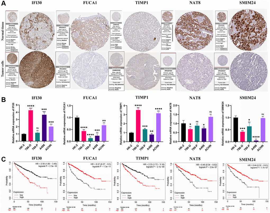 Validation of expression and survival of model genes. (A) The protein expression profiles of the key genes in the Human Protein Atlas (HPA) database. (B) The mRNA expression level of the key genes in a renal tubular epithelial cell line (HK-2) and KIRC cell lines (786-O, 769-P, A498, and ACHN). (C) Survival analysis for the key genes. Error bars are mean ± SD, *P **P ***P 