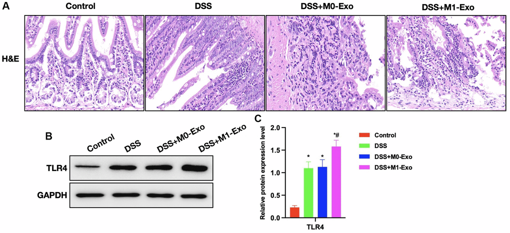 Role of M1-Exo in the pathology of colitis. (A) H&E (n = 5). Intestinal tissue in DSS group showed apparent edema, inflammatory tissue, and epithelial cell injury, while that in M1-Exo group showed aggravated mucosal destruction and obvious inflammatory response. (B, C) Relative protein levels (n = 5). TLR4 of DSS group were up-regulated, and further increased in M1-Exo group. *P #P 