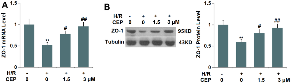 Cepharanthine (CEP) restored the expression of ZO-1 in brain bEND.3 endothelial cells. (A) mRNA of ZO-1; (B) Protein of ZO-1 as measured by western blot analysis (**, P