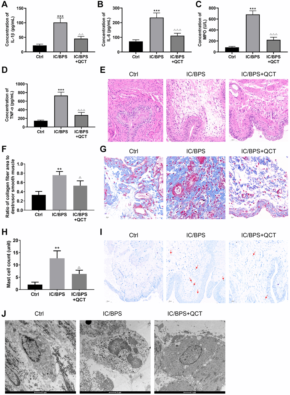 The effect of QCT on IC/BPS rats. ELISA kit detected the concentration of IL-1β (A), IL-6 (B), MPO (C), TNF-α (D). (E) HE staining was used to deserve the inflammatory of bladder tissue in rat. (F, G) Changes of collagen fibers in rat bladder tissue was performed by Masson staining. (H, I) TB staining observed the mast cells in bladder tissue of rat. (J) The degranulation of mast cells in rat bladder tissue was observed by transmission electron microscope. One-way ANOVA was used. Compared with Ctrl group, **P ***P ΔP ΔΔP ΔΔΔP n = 3.