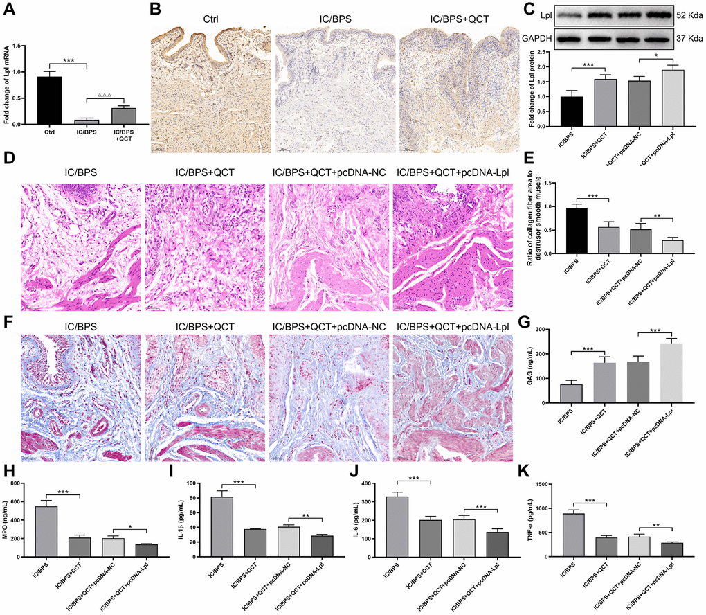 Lpl was involved in the therapeutic process of QCT on IC/BPS in rats. (A) Lpl mRNA expression was detected using RT-qPCR. (B) The IHC staining of bladder tissues. (C) The protein expression of Lpl. (D) The HE staining of bladder tissues. (E, F) Masson staining was used to evaluate the collagen and smooth muscle in bladder tissues. The levels of GAG (G), MPO (H), IL-1β (I), IL-6 (J), TNF-α (K). *P **P ***P 