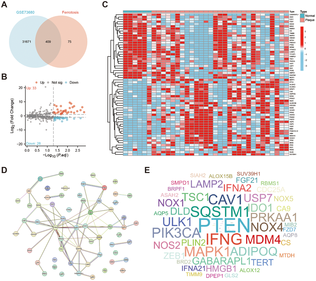 Identification of DEFERGs. (A) The Venn plot shows the number of ferroptosis-related genes that have intersections with the GSE73680 dataset (n=409). (B) The volcano plot of all DEFERGs between Normal and Plaque group (|Log2 FoldChange|≥1, adjusted P C) The heatmap of DEFERGs between Normal and CaOx group. (D) PPI networks of the 61 DEFERGs. (E) The word-cloud map shows the scale of the adjacent nodes of DEFERGs, reflecting the importance of genes.