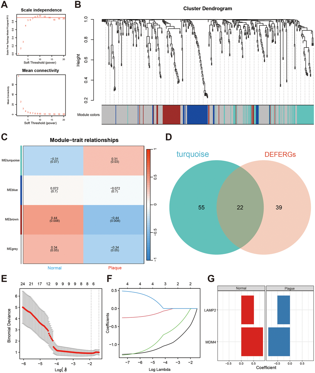 Screening the hub DEFERGs via WGCNA and machine learning. (A) The power value β, set at 8, is indicated by the red line, ensuring a robust R2 > 0.9. (B) The clustering dendrogram illustrates the amalgamation of gene co-expression modules, with each color signifying a distinct module. (C) The heatmap displays the correlation between modules and clinical traits, featuring correlation coefficients and corresponding P-values at the intersections of rows and columns. (D) The Venn plot illustrates the overlapping genes between DEFERGs and those found in the nephrolithiasis-related module (turquoise). (E, F) LASSO regression of the 22 intersected DEFERGs. (G) Coefficients between the two hub DEFERGs and the clinical portraits.