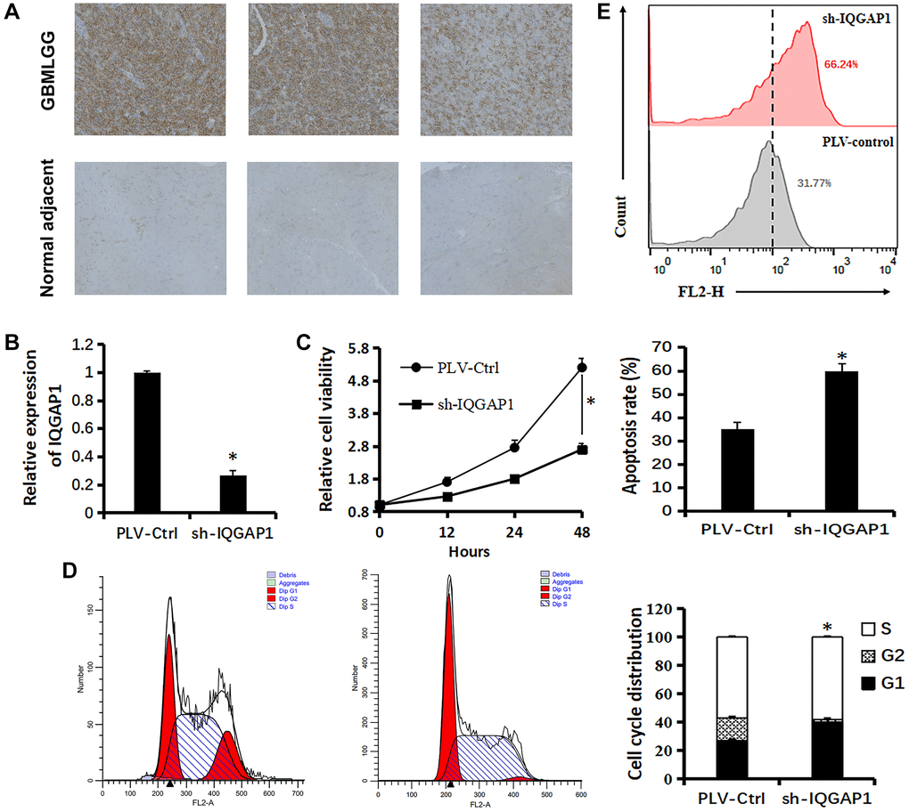 Relationship between IQGAP1 and viability of U87 cells. (A) Immunohistochemistry of IQGAP1 protein expression in GBMLGG and counterpart normal adjacent tissues. (B) qRT-PCR assay shows the transcriptional levels of the IQGAP1 gene with GAPDH used as the loading control in U87 cells. (C) Effect of sh-IQGAP1 on the proliferation of U87 cells was detected by CCK-8 assays. (D) The cell cycle distribution of U87 cells were measured using flow cytometry analyses. (E) Apoptosis of U87 cells induced by cisplatin (20 μM) were measured by flow cytometry analyses. Data are presented as the mean ± SD for three independent experiments (*P 