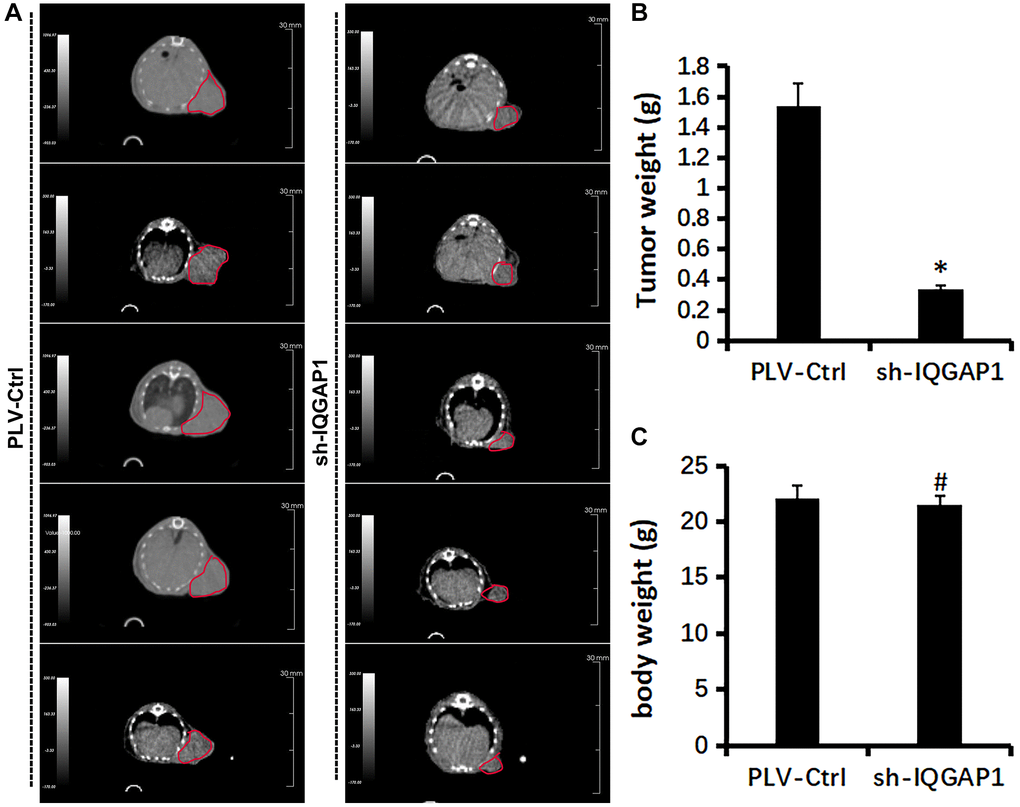 Effect of IQGAP1 knockdown on tumor growth of human glioma U87 xenografts. (A) Representative tumor images by Super Nova® PET/CT at 14th day after tumor implantation. (B) Body weight of mice. (C) Tumor weight. *P 