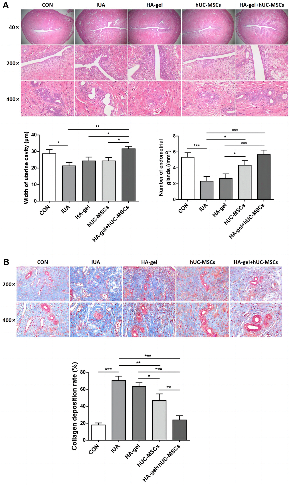 Effect of different treatments on endometrial regeneration and collagen remodeling. (A) HE stains shows the width of uterine cavity and number of endometrial glands; (B) Masson staining indicates the degree of endometrial fibrosis.