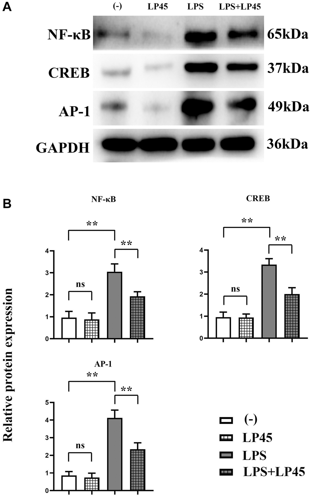 Detection of expressions of relevant proteins in osteoclasts via Western blotting. LP45 inhibits osteoclast formation by modulating histone proteases in macrophages and secreting exosomes to osteoclasts. (A) Detection of expressions of relevant proteins in osteoclasts via Western blotting. (B) Expression levels of relevant proteins in osteoclasts. **p 