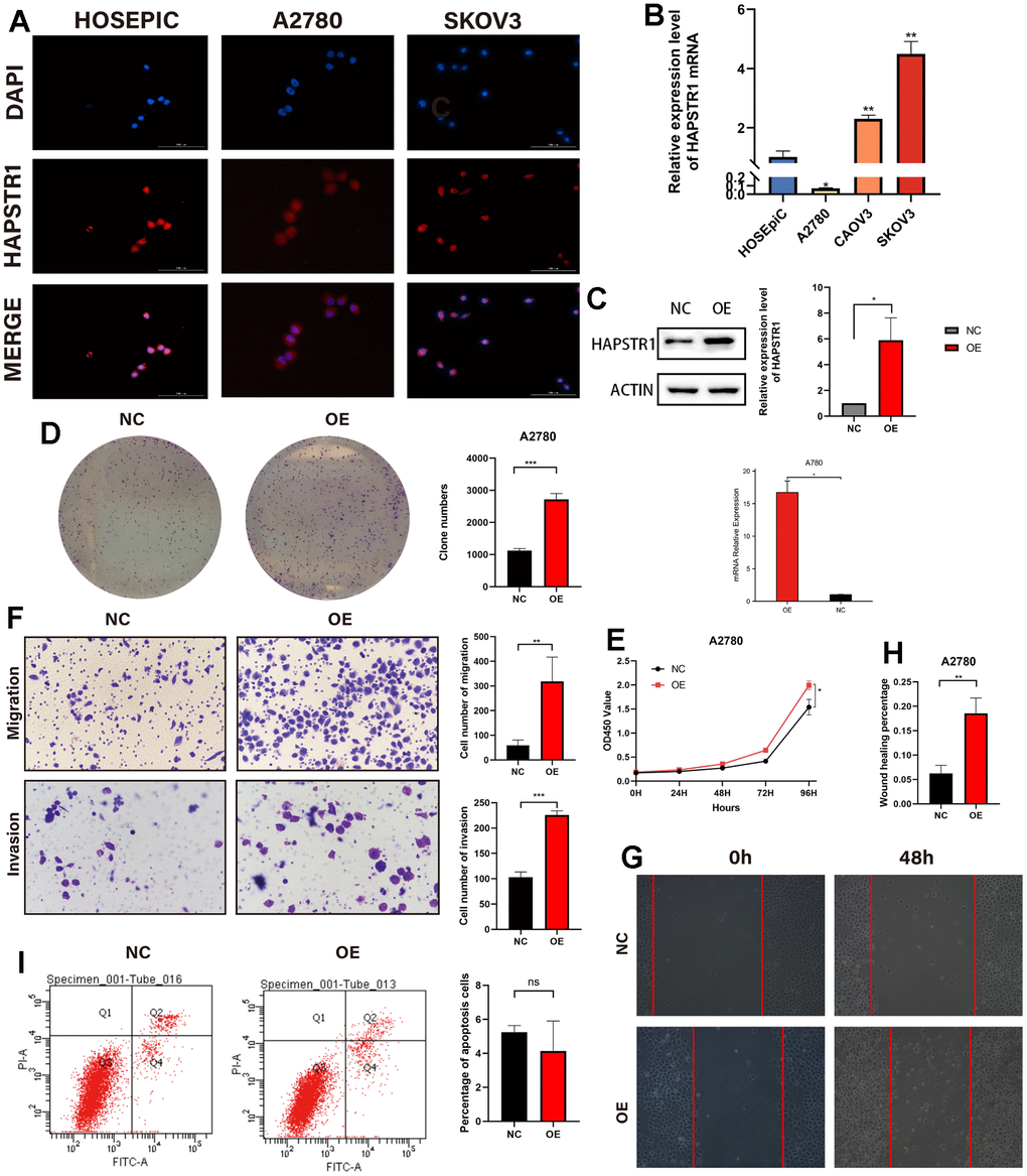 HAPSTR1 overexpression enhanced proliferation, migration, and invasion of ovarian cancer cells. (A) Cellular localization was visualized in an immunofluorescence staining assay with microscopic observation at 400x. (B) The mRNA expression level of HAPSTR1 was detected using real-time PCR. (C) Efficiency of HAPSTR1 overexpression was examined using real-time PCR and Western blotting assays. (D, E) Colony formation and CCK-8 assays were used to show improvements in proliferative capacity induced by HAPSTR1 overexpression. (F) The results of the transwell assay showed that HAPSTR1 overexpression enhanced migration and invasion. Original magnification, 200x. (G, H) A wound healing assay was performed to demonstrate increased migration caused by HAPSTR1 overexpression. (I) Flow cytometry was carried out to detect cell apoptosis rates. Each experiment was repeated with three independent replicates. *, p p p 