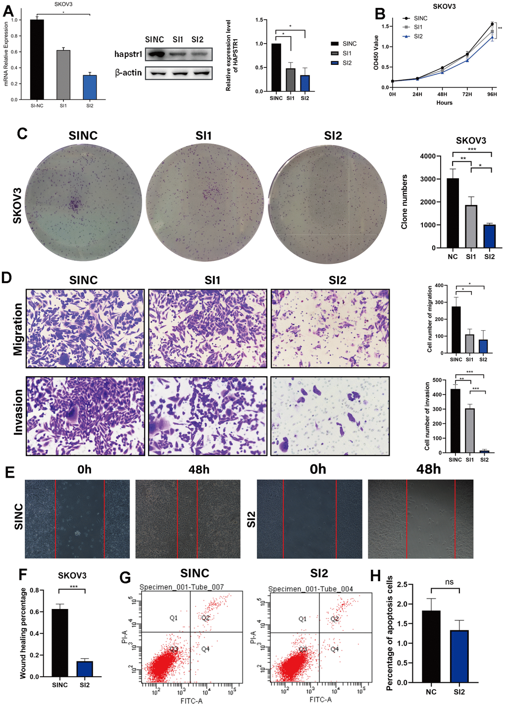 HAPSTR1 knockdown repressed the proliferation, migration, and invasion capacities of ovarian cancer cells. (A) Efficiency of HAPSTR1 knockdown was examined by real-time PCR and Western blotting assays. (B, C) The decline in cell viability induced by HAPSTR1 knockdown was detected by colony formation and CCK-8 assays. (D–F) The results of the transwell and wound healing assays showed that HAPSTR1 knockdown inhibited migration and invasion. Original magnification, 200x. (G, H) Flow cytometry was carried out to detect cell apoptosis rates. Each experiment was repeated with three independent replicates. *, p p p 