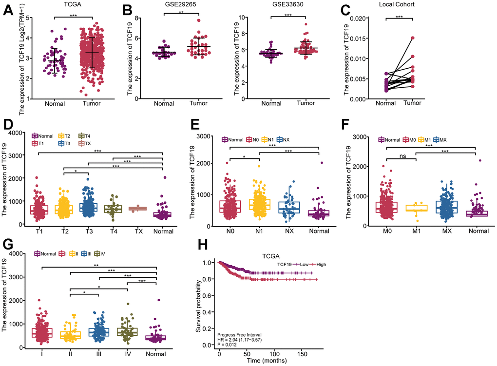 High expression of TCF19 is associated with poor prognosis in thyroid cancer. (A) The expression pattern of TCF19 in total was analyzed in 512 THCA tissues and 59 normal controls (TCGA database). (B) Kaplan-Meier analysis evaluating the association between Progress Free Interval and TCF19 expression in thyroid cancer patients (N=512) in the TCGA-THCA cohort. Progress Free Interval analysis was further stratified by TCF19-High and TCF19-Low characteristics for Kaplan–Meier analysis. (C) The expression pattern of TCF19 in GSE29265 and GSE33630, comparing normal thyroid tissues with thyroid cancer. (D–G) The relationship between TCF19 expression and T stage (D), N stage (E), M stage (F) and TNM stage (G) in TCGA cohort. (H) The expression pattern of TCF19 in 20 THCA tumor and their adjacent tissues. *p