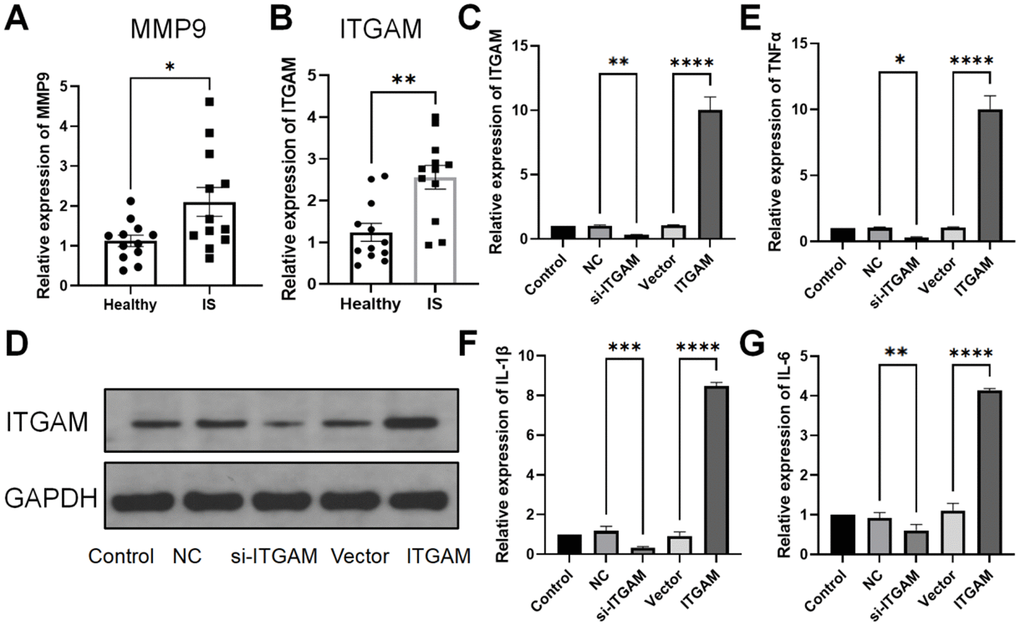 qPCR and Western blot. Relative expression analysis of MMP9 and ITGAM in IS and normal patients. (A, B) represent the relative expression of MMP9 and ITGAM mRNA in control and IS patients by qPCR. (C) q-PCR relative expression of ITGAM in different settings. (D) Western blot of ITGAM and GAPDH in different groups. (E–G) Relative expression of mRNA of TNF-α, IL-1β, and IL-6 when interfering with ITGAM in ischemic stroke. *P 