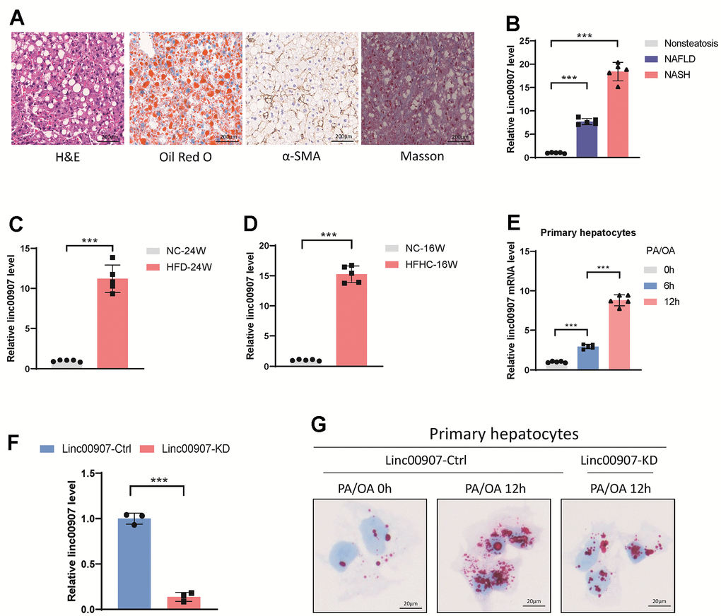 linc00907 upregulates in NAFLD and NASH. (A) Representative images of H&E, Oil Red O, α-SMA and Masson staining of liver sections from NASH mouse model; (B) linc00907 upregulates in both NAFLD and NASH; (C, D) linc00907 upregulates in NASH conditions established via HFD (C) and HFHC (D) as opposed to normal mouse liver tissues; (E) linc00907 upregulates in the NASH cellular model; (F) qRT-PCR analysis has confirmed the effective knockdown of linc00907 within the cells; (G) lipid accumulation was significantly mitigated upon knockdown of linc00907.